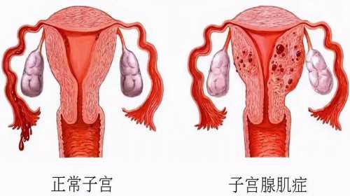 广州试管代怀介绍|孕育常识：辽阳卵巢发育不全能做第三代试管婴儿吗