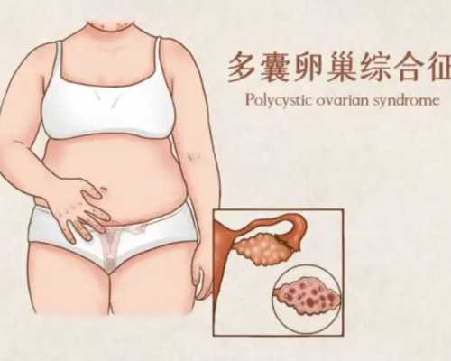 广州代孕妈妈最低多少钱|试管婴儿胚胎移植能看出男女吗