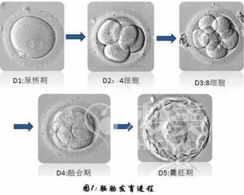 广州试管代孕多少钱明细表|做试管婴儿移植痛吗？试管移植胚胎有痛苦吗？