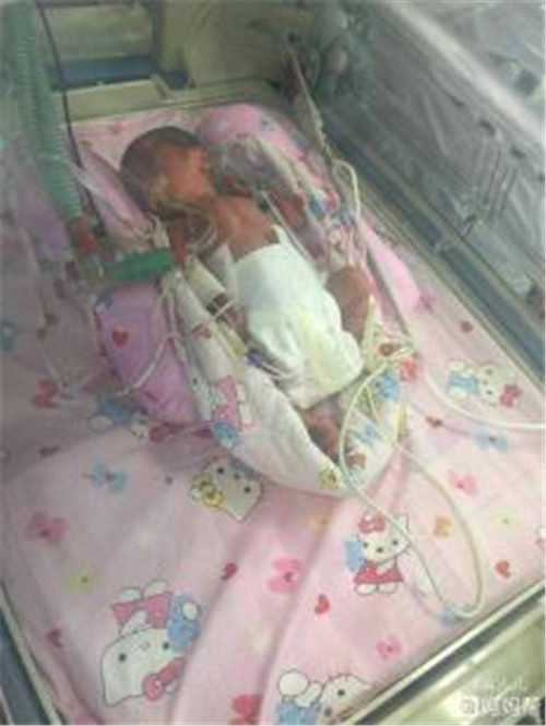 哈尔滨代生孩子官网 哈尔滨试管婴儿私立医院选择私立医院有方法 ‘b超单子数